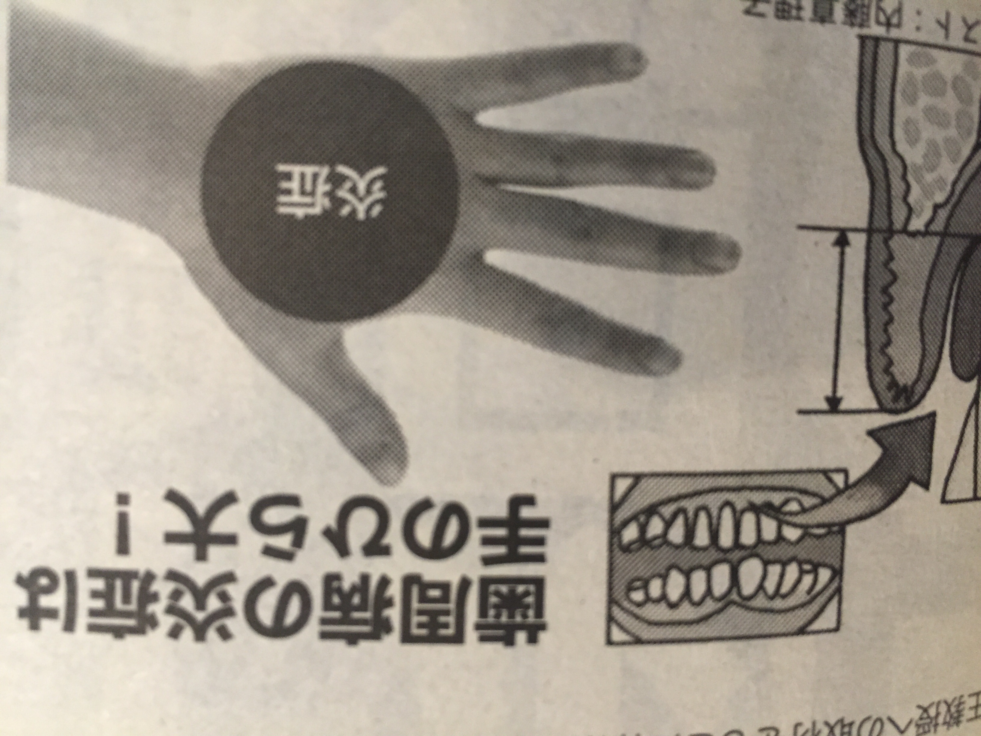 フロスか死(心臓病)か？の新聞記事