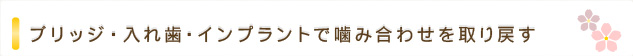 ブリッジ・入れ歯・インプラントで噛み合わせを取り戻す